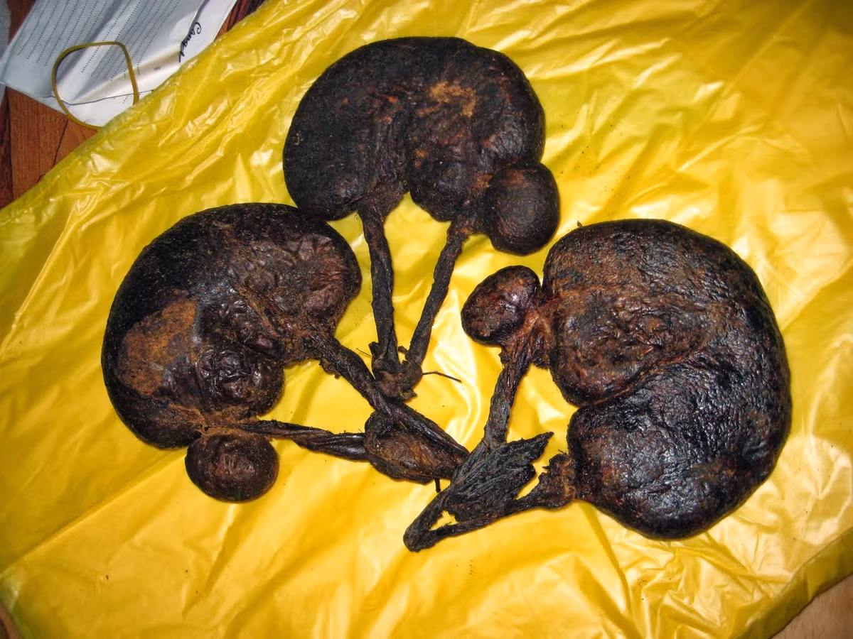 7. Dùng dạ dày nhím: Đốt tồn tính dạ dày nhím, mỗi lần uống 8g, hòa với rượu uống. Chữa thủy thũng, cổ trướng, hoàng đản. Ảnh: chuyenkhoadaday.com.