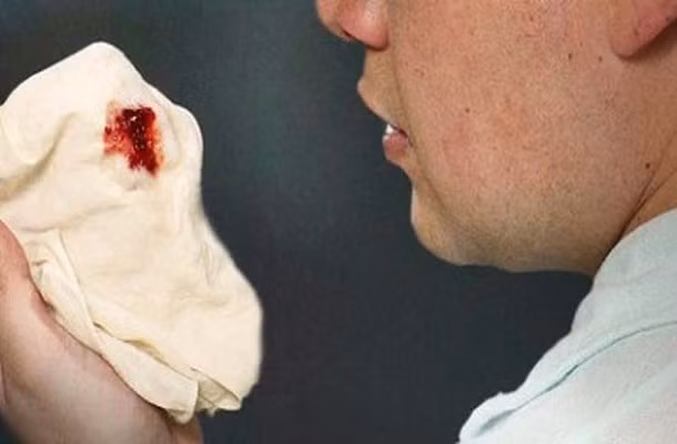 2. Chữa bệnh xuất huyết: Dùng râu ngô tươi hoặc phơi khô sắc nước uống hàng ngày, có thể kết hợp thêm các vị khác như cỏ nhọ nồi, huyết dụ, trắc bách diệp, lá sen,… để tăng thêm công dụng. Ảnh: CumarGoldFast.vn.