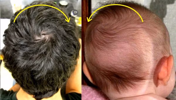 4. Xoáy tóc ngược chiều: Chiều thuận của xoáy tóc thường là chiều kim đồng hồ, trái chiều là các xoáy ngược lại. Những người có xoáy ngược chiều này thường có tính khí thất thường, không ổn định và khó giữ vững lập trường, không có chính kiến bản thân trong cả cuộc sống và công việc. Ảnh: eva.vn.