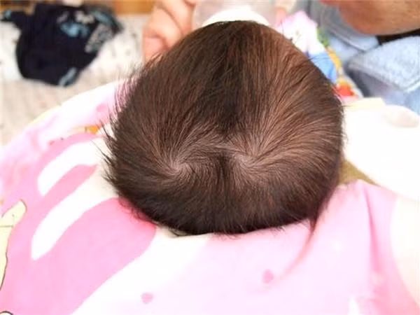 2. Hai xoáy tóc: Nhân tướng học đánh giá đây là những bé lớn lên thông minh, nhanh trí, nhớ nhanh, tư duy tốt, sáng tạo, nhiều ý tưởng độc đáo. Ảnh: eva.vn.