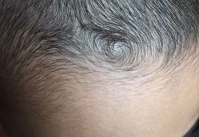 5. Xoáy tóc trước trán: Những đứa trẻ có xoáy tóc trước trán lớn lên thường ham hiểu biết, thích những điều mới lạ. Con cũng là những người dám nghĩ dám làm, dũng cảm, thích hợp với những công việc mang tính chất khai phá và cũng được đánh giá là người tự tin, giao tiếp tốt. Ảnh: 2Sao.vn.