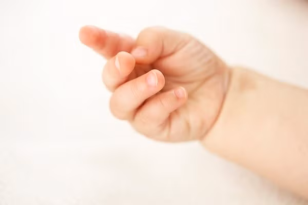 5. Móng tay bé bị lõm vào ở giữa: Móng tay bé bị lõm ở giữa, có hình dạng giống như chiếc muỗng là dấu hiệu của tình trạng thiếu sắt. Ngoài ra, khi cơ thể bé đang gặp các vấn đề về thận, rối loạn chức năng tuyến giáp hoặc cơ xương cũng sẽ gây ra tình trạng lõm móng tay ở các bé. Ảnh: khoeplus.org.vn.