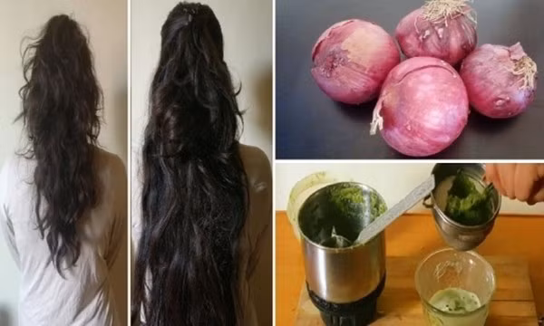 Thêm hành tây đã được xắt nhỏ. Thêm chút nước và xay. Bôi hỗn hợp nhận được lên da đầu. Để khoảng 60 phút. Gội lại bằng dầu gội và dầu xả như bình thường. Ảnh: kenhphunu.com.