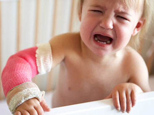 4. Gãy tay, chân: Những đau đớn về mặt thể xác là một phần, đau do gãy tay, chân còn khiến trẻ mang tâm lý tự ti về thân thể trong một thời gian dài. Ảnh: thuvienhuongdan.com.