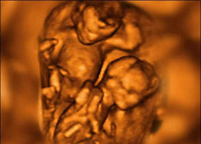 Anh em thân thiết