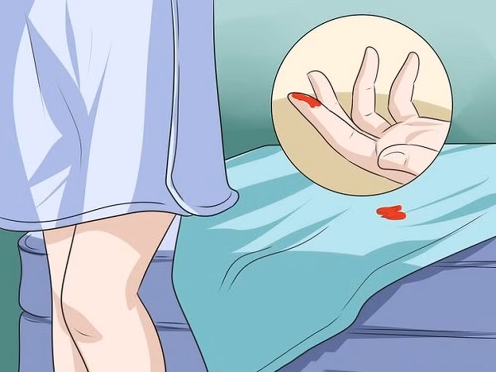 Một dấu hiệu khác của ung thư âm hộ là hiện tượng chảy máu âm đạo bất thường khi không trong chu kỳ kinh nguyệt. Ảnh: topbenh.