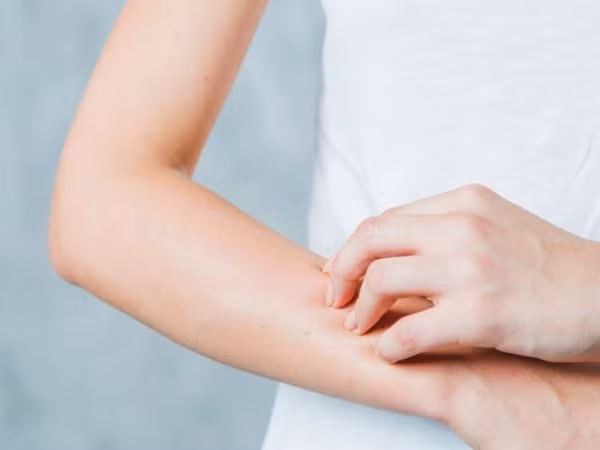  Gãi ngứa da: Thời tiết nóng của mùa hè có thể gây ra ngứa và mẩn đỏ trên da. Nhiều người có thói quen gãi để giảm ngứa nhưng điều này có thể gây ngứa nhiều hơn. Cách tốt nhất là giữ ẩm cho da. Bạn cần thoa kem dưỡng ẩm hàng ngày không chỉ cho da mặt mà còn cho cả da toàn thân sau khi tắm. Tránh dùng nước ấm sẽ khiến da bị ngứa.