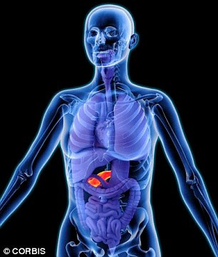 Đây là một bệnh có tỷ lệ tử vong rất cao, chỉ có 3% người mắc bệnh có thể sống sót trong 5 năm. 