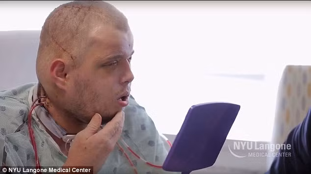 Anh Patrick Hardison là một lính cứu hỏa người Mỹ. Vào năm 2001, sau lần cố gắng giải cứu một người phụ nữ trong căn nhà cháy lớn anh đã bị bỏng nặng, khuôn mặt anh hoàn toàn biến dạng.