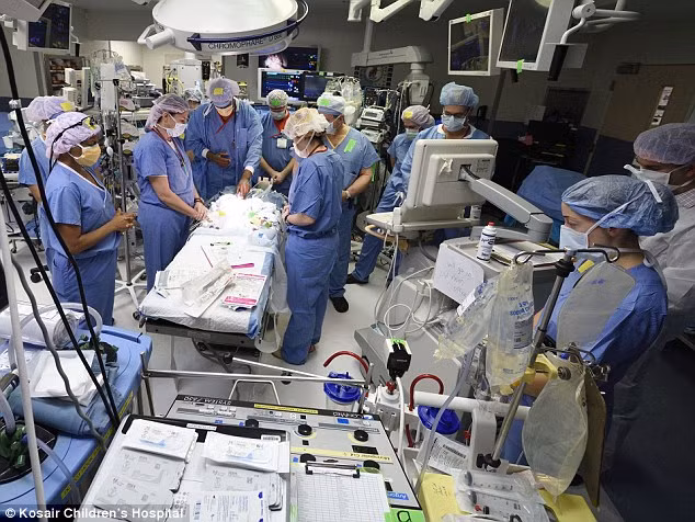 Tỷ lệ sống sót của các cặp song sinh dính liền chỉ từ 5 - 25%. Lịch sử ghi nhận có khoảng 600 trường hợp song sinh dính liền sống sót trong 500 năm qua với hơn 70% trường hợp cả hai đều là nữ.