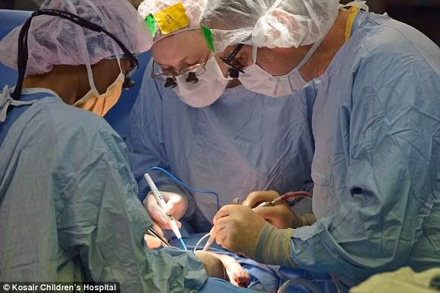 Các bác sĩ cho hay, quyết định phẫu thuật có thể mạo hiểm nhưng vẫn có những tín hiệu lạc quan và những em bé có thể phải dùng máy trợ tim sau phẫu thuật.