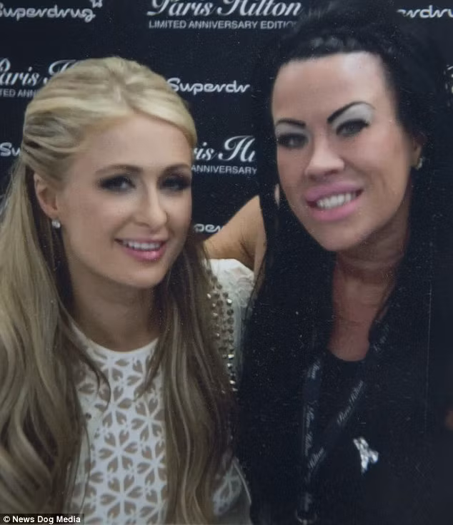 Trước đó, cô này thừa nhận bị ám ảnh với phẫu thuật thẩm mỹ và người nổi tiếng. Ước mơ của cô là muốn trở nên xinh đẹp như Paris Hilton. Từ câu chuyện của mình, Lisa hy vọng mọi người nên tránh xa việc tiêm chất độn vào môi hoặc bất cứ bộ phận nào khác trên cơ thể.