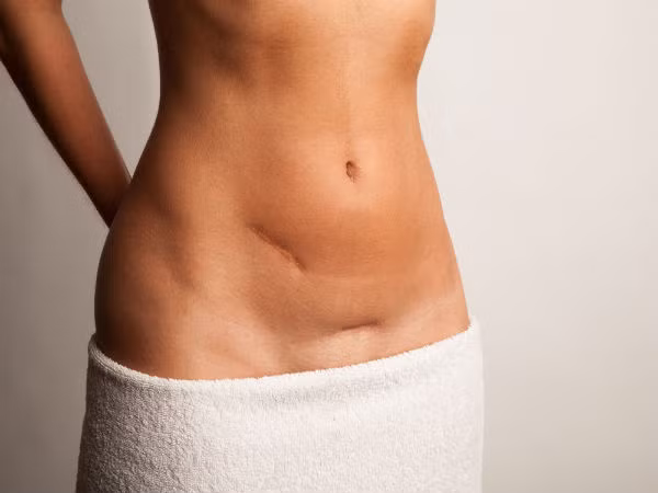 Ung thư cổ tử cung là căn bệnh ung thư thường gặp ở phụ nữ. Ở phụ nữ Châu Á, ung thư tử cung lấy đi sinh mạng của hơn 2.000 người mỗi năm. Chỉ tính riêng Ấn Độ, có hơn 1/3 số phụ nữ tử vong vì ung thư tử cung trong tổng số các trường hợp mắc ung thư. Nguyên nhân của căn bệnh ung thư này là do quan hệ tình dục ở độ tuổi quá sớm, nhiều bạn tình và không có biện pháp bảo vệ khi quan hệ. Nhiễm HIV cũng là một trong những nguyên nhân dẫn đến ung thư tử cung ở phụ nữ.