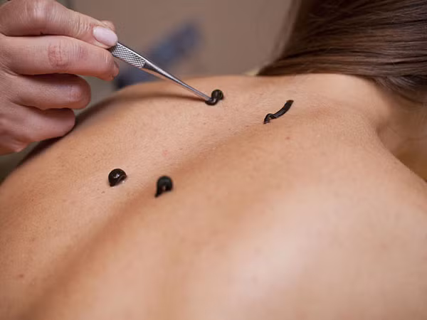 Dưỡng da bằng đỉa. Đa số chúng ta sẽ cảm thấy ghê rợn khi nhìn thấy loài vật này bò lổm ngổm trên mặt, tuy nhiên, đây lại là hình thức làm đẹp cho da mặt rất hiệu quả. Trước khi dùng phương pháp trị liệu này bạn sẽ phải tắm với nhựa thông sau đó là làm sạch lông. Bắt đỉa bỏ lên da cho chúng hút máu và hút luôn các độc tố trong người, da sẽ căng mịn vì độc tố đã bị loại bỏ.