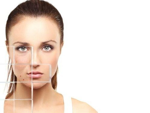 Rượu cũng ức chế hoạt động của các enzym mà cơ thể dùng để chống lại quá trình viêm da phá hủy. Do đó, một vài ly rượu cũng đủ để khiến má và mũi đỏ bừng, đây cũng chính là cơ chế gây đỏ mặt của một số người khi uống rượu.