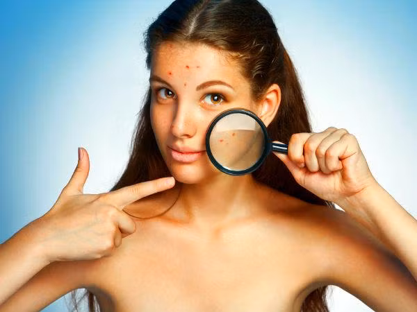 Mụn trứng cá. Steroid là tác nhân thường được sử dụng trong điều trị ung thư có thể dẫn đến mụn trứng cá. Bạn có thể dùng yến mạch để tẩy da chết và làm se các vết mụn nhanh nhất. Đặc tính chống viêm và chống oxy hóa của yến mạch giúp làm giảm kích ứng da và các vết mụn đỏ.