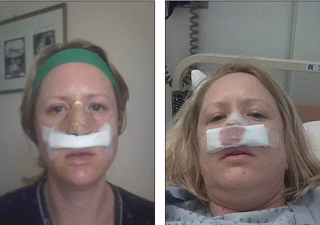 Năm 2008, Lois phải trải qua ca phẫu thuật cắt bỏ vùng nhiễm khuẩn và những phần thịt hoại tử bên trong khuôn mặt.