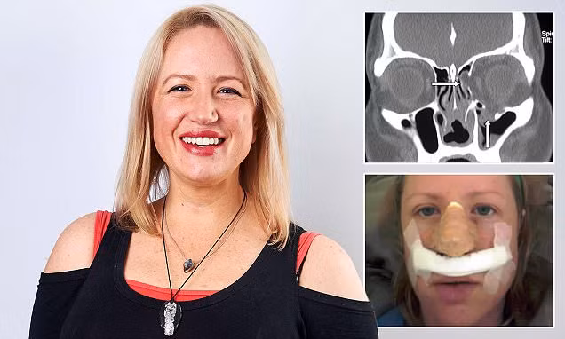 Cô Lois Temel, 41 tuổi, đến từ Ryde, Australia cảm thấy đau đớn, mệt mỏi liên tục và đã đi khám bệnh, tuy nhiên bác sĩ không thể biết rõ nguyên nhân là gì.