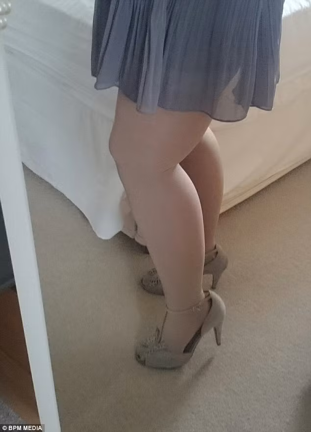 Sau khi hút 12 lít mỡ, vòng chân Faye giảm xuống còn 40 cm và trọng lượng giảm xuống còn 85 kg. Trong quá trình hút mỡ, bác sĩ đã phẫu thuật lấy đi khoảng 2,3 kg da thừa.