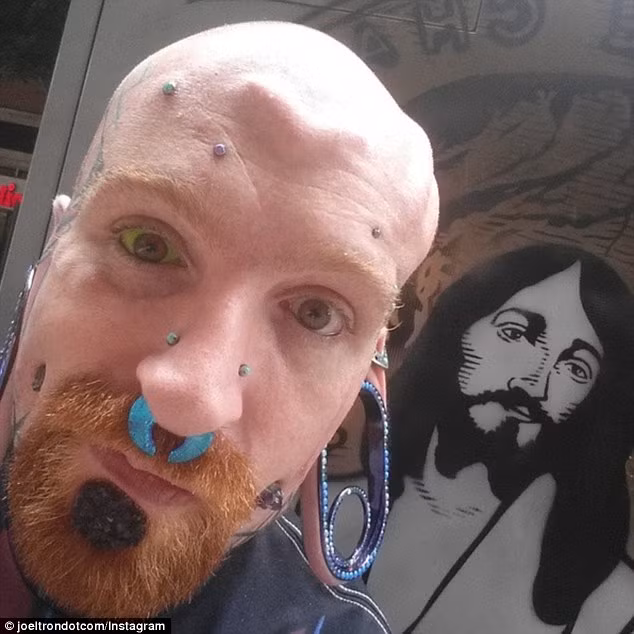 Để xăm nhãn cầu, người ta phải tiêm mực vào mắt để nó lan ra và nhuộm kín xung quanh.