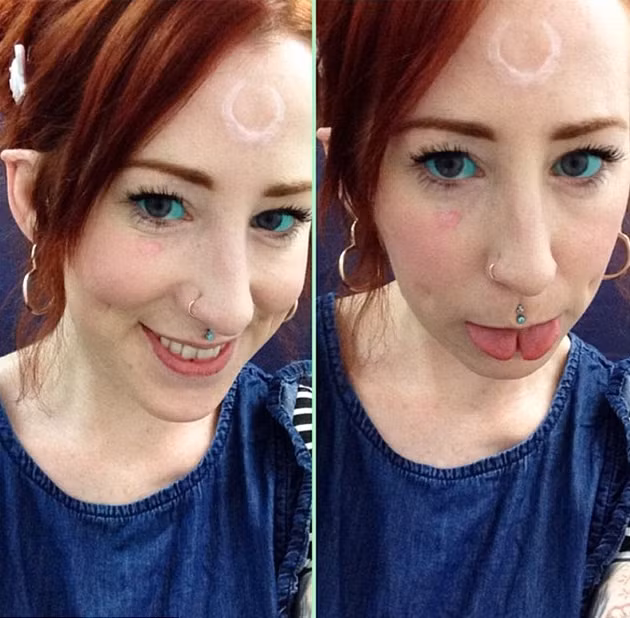 Việc làm này có thể gây nhiễm trùng cho mắt hoặc cũng có thể loại mực tiêm vào sẽ gây các phản ứng khôn lường mà trong thời gian ngắn, người xăm chưa thể thấy được.