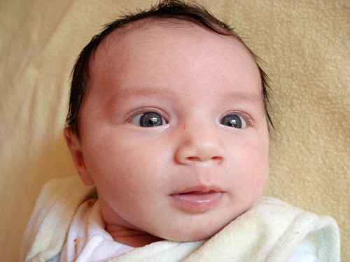 Thông thường, trẻ bị viêm màng não nặng sẽ để lại một số di chứng như mắt lé, giảm thính lực, yếu chân tay, não úng thủy. Với bệnh nhi từng có tổn thương ở não thường có khả năng viêm màng não mủ tái phát ở mức cao. Cụ thể, các biến chứng dưới đây thường xuất hiện sau 2 tuần mắc viêm màng não mủ: