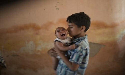 Vừa qua, Việt Nam đã ghi nhận trường hợp trẻ đầu tiên mắc chứng đầu nhỏ nghi có liên quan đến vi rút Zika. Ảnh minh họa