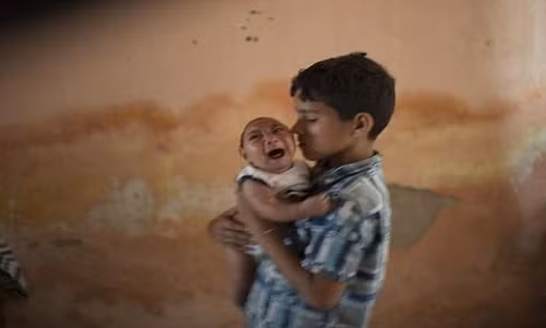 Vừa qua, Việt Nam đã ghi nhận trường hợp trẻ đầu tiên mắc chứng đầu nhỏ nghi có liên quan đến vi rút Zika. Ảnh minh họa