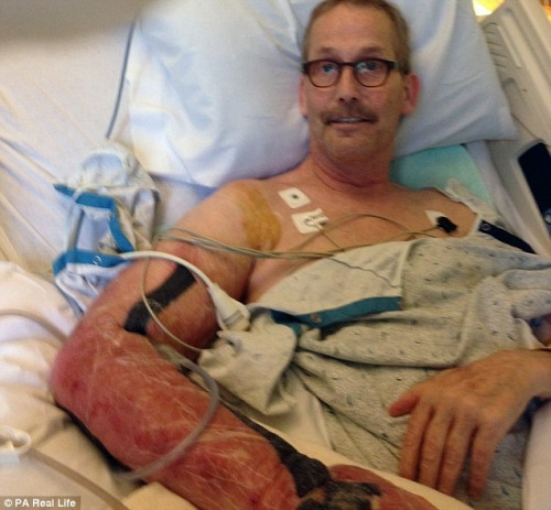 So hai can benh la quai ac khien tay chan rung dan-Hinh-3