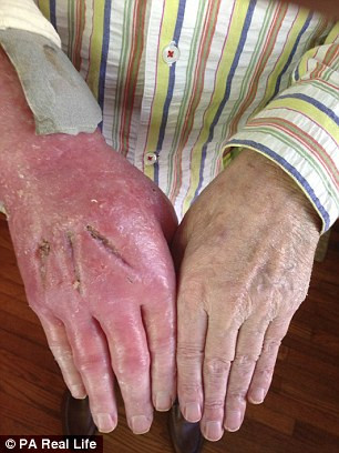 So hai can benh la quai ac khien tay chan rung dan-Hinh-6