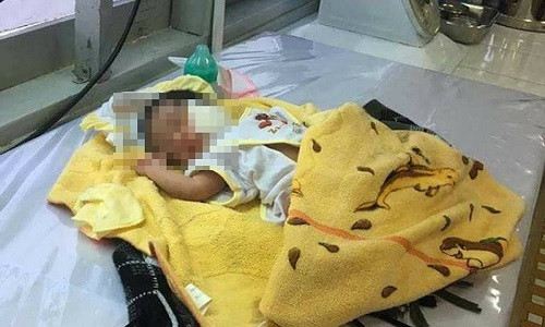 Cháu bé được cứu sống. Ảnh: KN