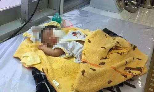 Cháu bé được cứu sống. Ảnh: KN