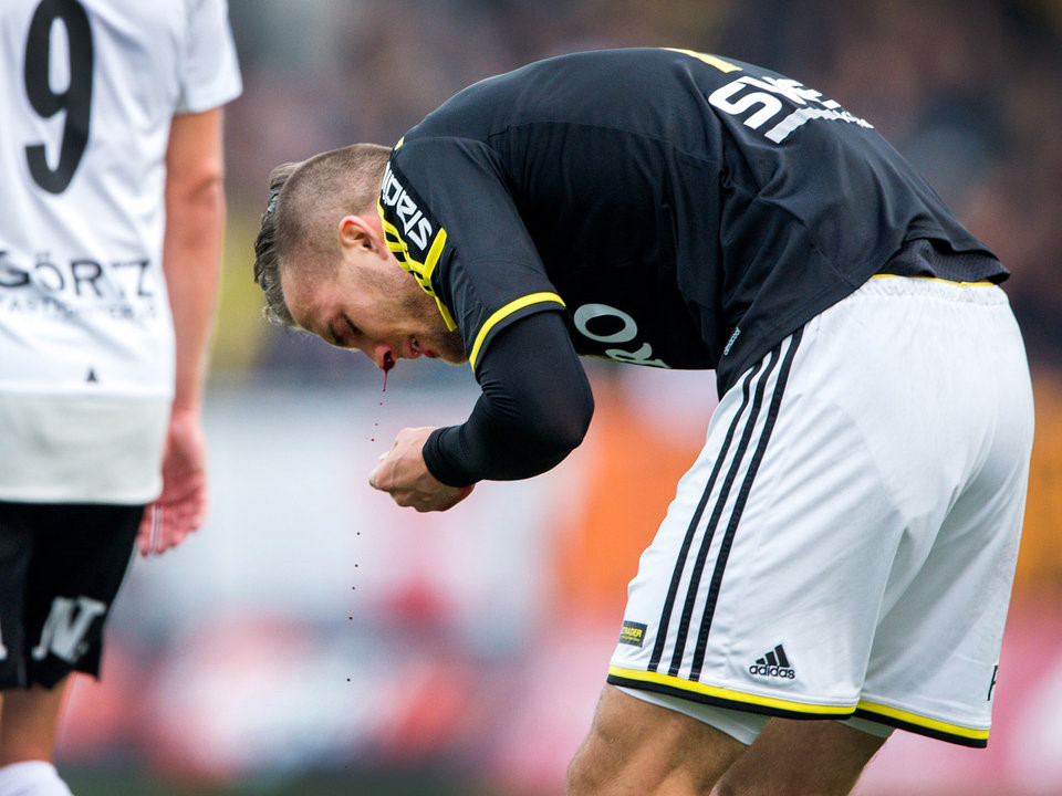 Ngửa mặt lên trời sẽ khiến máu cam ngừng chảy: Khi còn nhỏ, bạn có thể được dạy rằng ngửa mặt lên trời có thể ngăn chảy máu cam. Tuy nhiên, các bác sĩ cho rằng đây không phải giải pháp tốt. Thay vì ngửa mặt, bạn nên cúi đầu về phía trước và bóp mũi để ngăn dòng máu chảy ra. Ngửa mặt lên trên không những chẳng làm cho máu cam ngừng chảy mà còn có thể dẫn đến những tổn thương khác. Nó có thể khiến máu chảy vào cổ họng, dạ dày và xuất hiện những chiến chứng khó chịu hơn nữa.