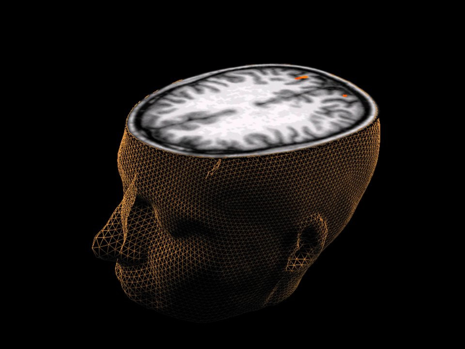 Con người chỉ sử dụng 10% bộ não: Có thể bạn đã nghe về điều này ở trường hoặc trong một số bộ phim nào đó. Tuy nhiên, ý tưởng về việc con người chưa sử dụng đến 90% bộ não là không đúng sự thật. Tất cả neuron thần kinh trong não có thể không hoạt động cùng một lúc nhưng không có nghĩa các bộ phận của não không hoạt động. Barry Gordon, một nhà thần kinh học tại Trường Y Johns Hopkins, Mỹ, cho biết chúng ta sử dụng gần như mọi bộ phận của não và phần lớn não bộ hoạt động gần như mọi lúc.