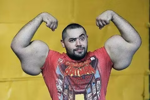 Anh Mostafa Ismail đến từ Ai Cập nắm giữ kỷ lục người có bắp tay to nhất với đường kính bắp tay là 78,4cm. Ảnh Oddee.