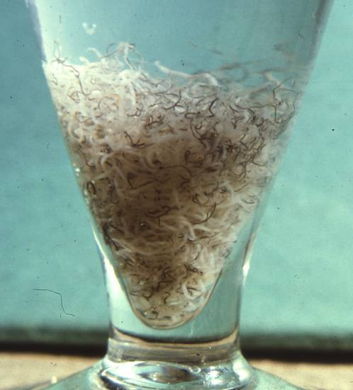 Sán Schistosoma mansoni khi ký sinh trong cơ thể con người sẽ gây ra bệnh sán máng - một căn bệnh vô cùng khó chịu. Ảnh metapathogen.