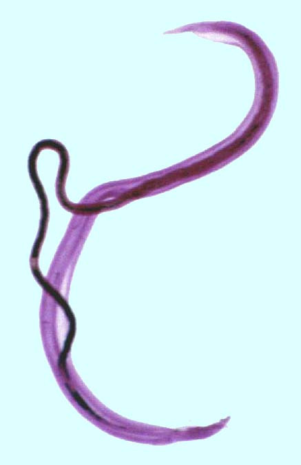 Sán Schistosoma mansoni thuộc nhóm sán lá máu, sống trong các mạch máu gần ruột trong cơ thể người và gây bệnh sán máng đường ruột. Ảnh k-state.