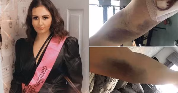 Cum nang roi co the bam tim, nguoi phu nu qua doi chi trong vong mot tuan