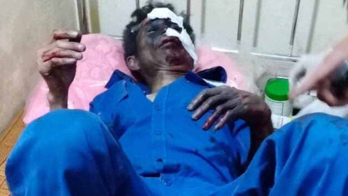 Kinh hoang chiec xe bon cho 12 ngan lit xang boc chay du doi-Hinh-2