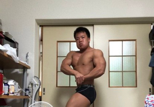 Nho cung luc 4 chiec rang khon, thanh nien mat sung nhu qua du du