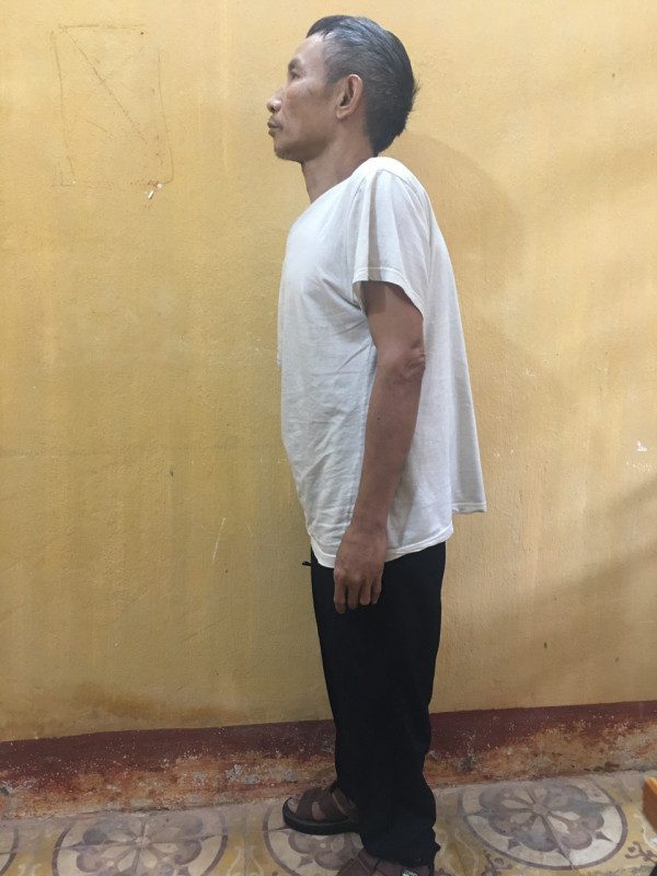 Ngày 7/9/1990, Thành “gù” đi ăn sáng tại khu vực Chợ Con. “Chả hiểu sao hôm đó giời xui đất khiến thế nào mà khi vào quán tôi lại cứ nhìn trân trân vào mặt anh ta. Thấy vậy, anh ta bảo: “mày thích nhìn đểu tao à. Sau khi lời qua tiếng lại, anh ta đấm một phát vào mặt khiến tôi choáng váng”, Thành “gù” nhớ lại. Sau khi bị một cú đấm trời giáng, Thành “gù” rút dao đâm thẳng vào đối phương khiến nạn nhân Phạm Văn Bình, sinh 1959 tử vong. Sau nhát đâm đó, Thành “gù” vùng bỏ chạy và kết quả là ông ta đã chạy một mạch suốt 33 năm. (Ảnh: CAND) 