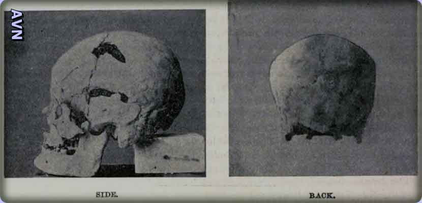 Khi các chuyên gia tiến hành so sánh hài cốt của vua Sanakht so với các pharaoh Ai Cập khác thì thấy không có ai gặp trường hợp tương tự.