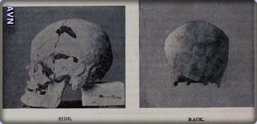 Khi các chuyên gia tiến hành so sánh hài cốt của vua Sanakht so với các pharaoh Ai Cập khác thì thấy không có ai gặp trường hợp tương tự.