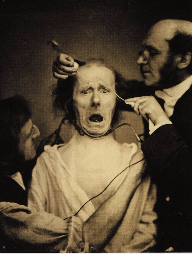 Nhà thần kinh học người Pháp Duchenne de Boulogne thực hiện thí nghiệm cho điện giật nhẹ lên khuôn mặt một người đàn ông khiến nhiều người không khỏi rùng mình sợ hãi. Bức ảnh chụp năm 1862.