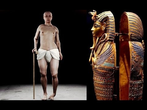 Thêm nữa, Tutankhamun có một bàn chân vẹo, hông biến dạng và dấu vết cho thấy nhà vua mắc bệnh động kinh.