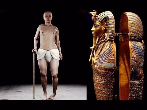 Thêm nữa, Tutankhamun có một bàn chân vẹo, hông biến dạng và dấu vết cho thấy nhà vua mắc bệnh động kinh.