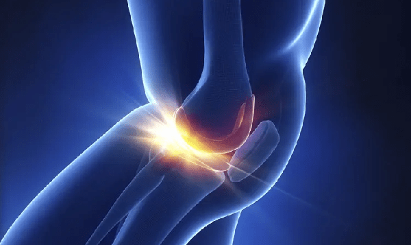 Để nhận được lợi ích sức khỏe từ mướp đắng, bác Trương ăn loại quả này quanh năm. Gần đây, bác cảm thấy xương khớp có vấn đề nên đi khám. Thật không ngờ, bác được chẩn đoán bị loãng xương dù rất chú trọng dinh dưỡng hàng ngày. Tìm hiểu về thói quen ăn uống, bác sĩ cho rằng thói quen ăn nhiều mướp đắng có thể là nguyên nhân khiến bệnh nhân xương “rỗ như tổ ong”. (Ảnh: Sohu)