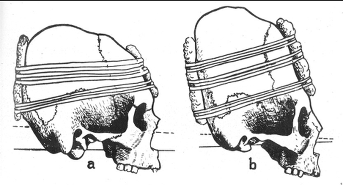Mặc dù có nhiều thông tin về những phát hiện này, nhưng nguyên nhân vì sao những người này bị hiến tế trong nghi lễ tàn bạo vẫn là một bí ẩn.