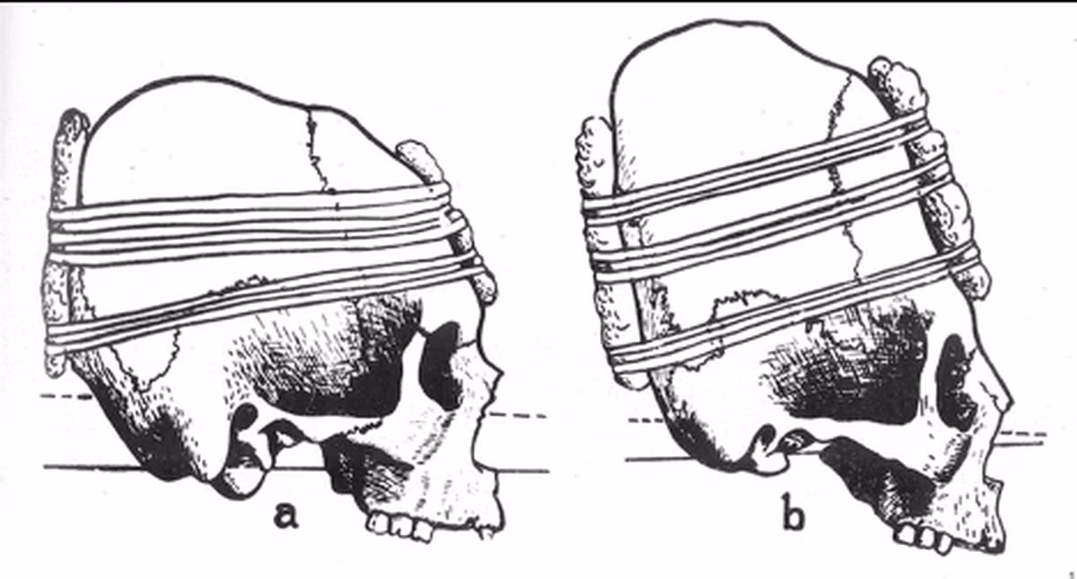 Mặc dù có nhiều thông tin về những phát hiện này, nhưng nguyên nhân vì sao những người này bị hiến tế trong nghi lễ tàn bạo vẫn là một bí ẩn.