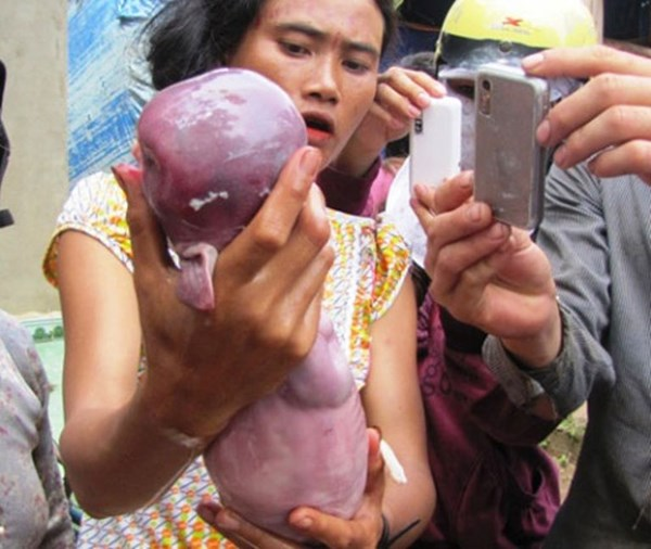 Tháng 10/2012, người dân ở tỉnh Bình Phước đã xôn xao về việc con heo của vợ chồng chị Thị Khoai, dân tộc Stiêng ở ấp 2, xã Minh Lập, huyện Chơn Thành, tỉnh Bình Phước sinh được một lợn con có hình dạng giống trẻ sơ sinh với đầu tròn, thân không có lông, da trơn, lưng rất thẳng.
